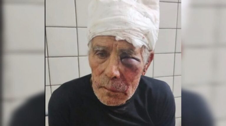 Detienen a tres hombres por el violento asalto en la bicicletería de Oscar Orono